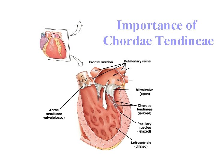 Importance of Chordae Tendineae 