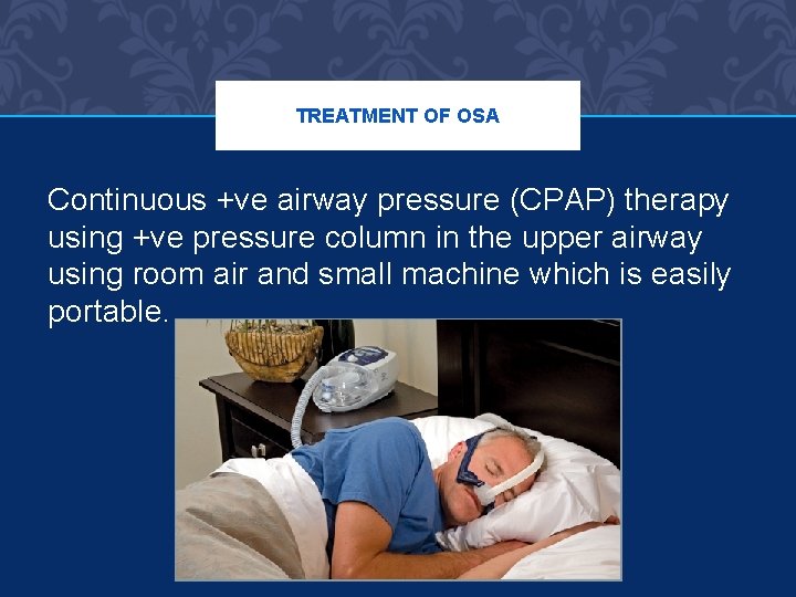 TREATMENT OF OSA Continuous +ve airway pressure (CPAP) therapy using +ve pressure column in