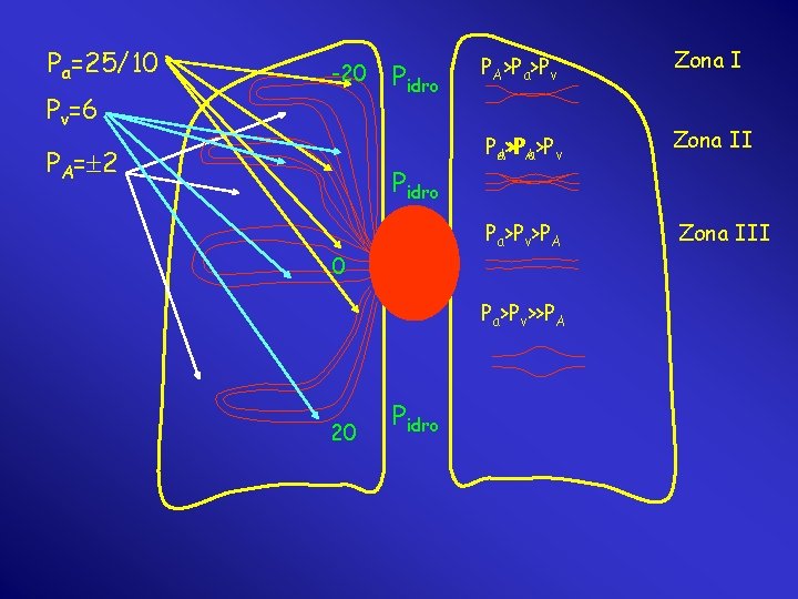 Pa=25/10 -20 Pv=6 PA= 2 Pidro 0 PA>Pa>Pv Zona I PAa>P >PAa>Pv Zona II