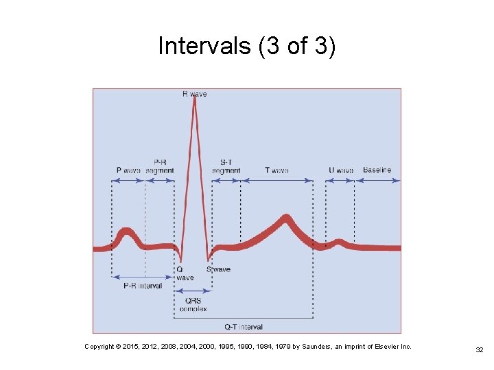 Intervals (3 of 3) Copyright © 2015, 2012, 2008, 2004, 2000, 1995, 1990, 1984, Intervals (3 of 3) Copyright © 2015, 2012, 2008, 2004, 2000, 1995, 1990, 1984,