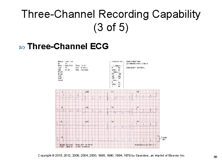 Three-Channel Recording Capability (3 of 5) Three-Channel ECG Copyright © 2015, 2012, 2008, 2004,