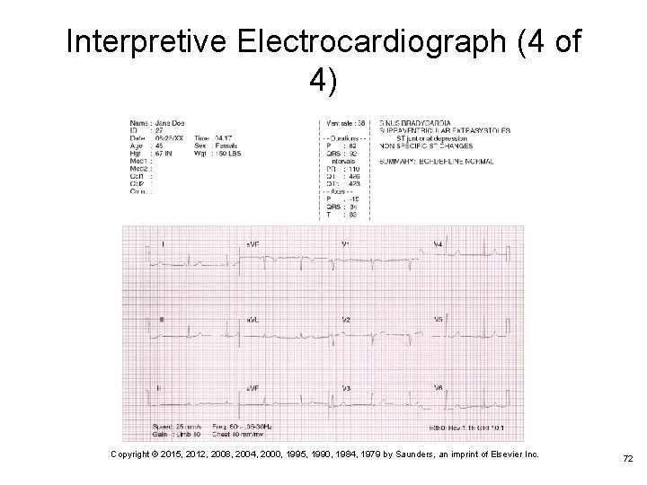 Interpretive Electrocardiograph (4 of 4) Copyright © 2015, 2012, 2008, 2004, 2000, 1995, 1990,