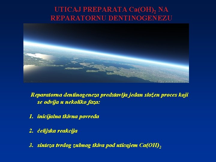 UTICAJ PREPARATA Ca(OH)2 NA REPARATORNU DENTINOGENEZU Reparatorna dentinogeneza predstavlja jedan složen proces koji se