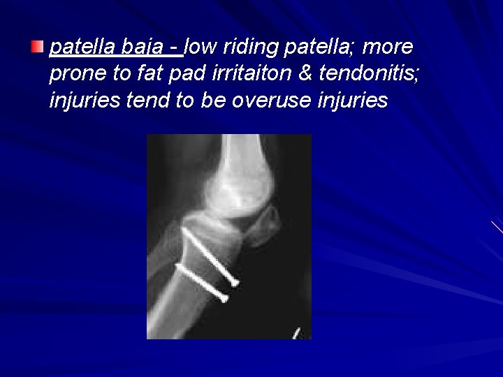 patella baja - low riding patella; more prone to fat pad irritaiton & tendonitis;