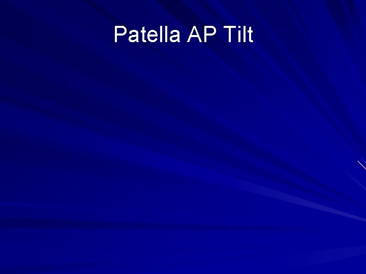 Patella AP Tilt 