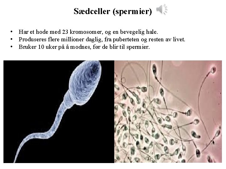 Sædceller (spermier) • Har et hode med 23 kromosomer, og en bevegelig hale. •