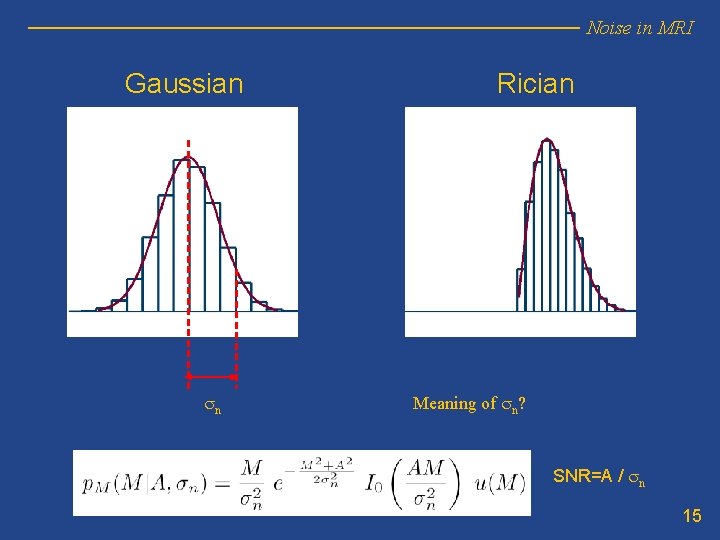 Noise in MRI Gaussian sn Rician Meaning of sn? SNR=A / sn 15 Noise in MRI Gaussian sn Rician Meaning of sn? SNR=A / sn 15