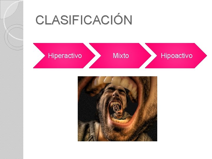 CLASIFICACIÓN Hiperactivo Mixto Hipoactivo 