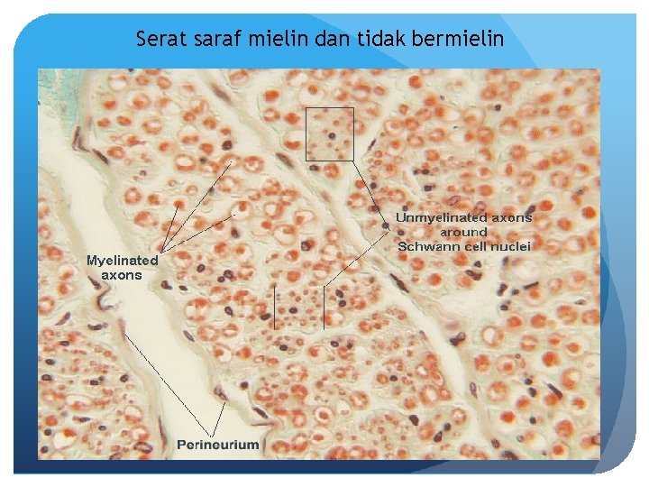 Serat saraf mielin dan tidak bermielin 