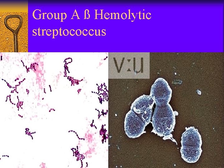 Group A ß Hemolytic streptococcus 