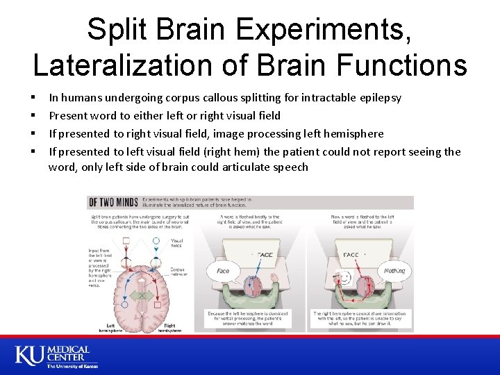 Split Brain Experiments, Lateralization of Brain Functions § § In humans undergoing corpus callous