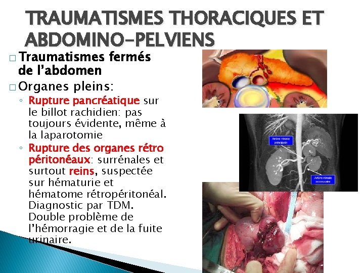 TRAUMATISMES THORACIQUES ET ABDOMINO-PELVIENS � Traumatismes fermés de l’abdomen � Organes pleins: ◦ Rupture