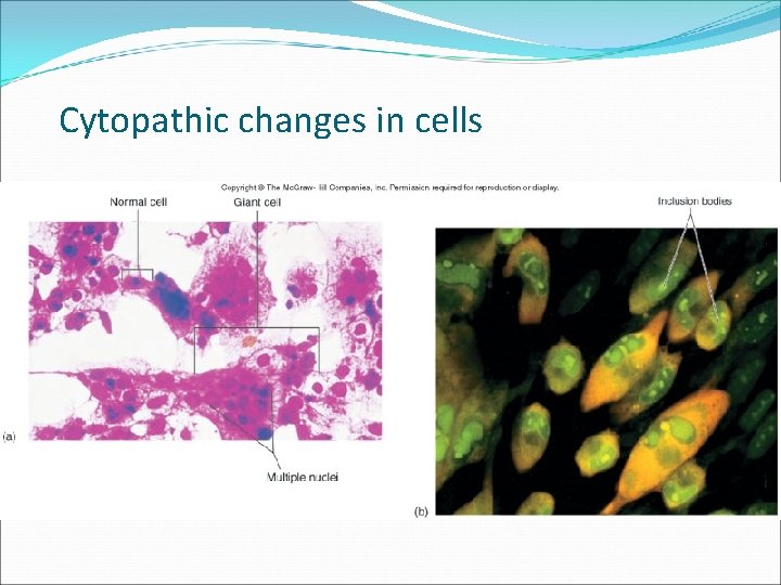 Cytopathic changes in cells 