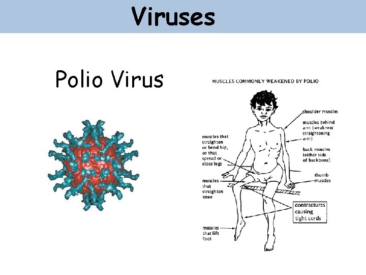 Viruses Polio Virus 
