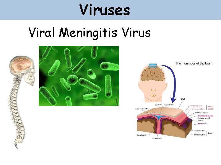 Viruses Viral Meningitis Virus 