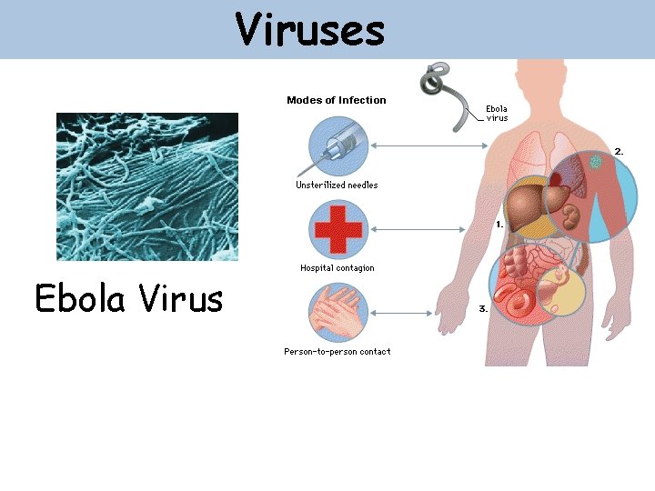 Viruses Ebola Virus 