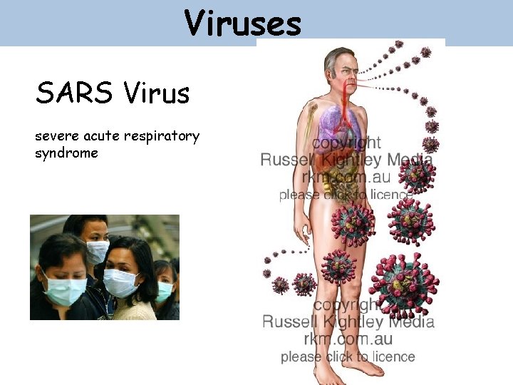Viruses SARS Virus severe acute respiratory syndrome 