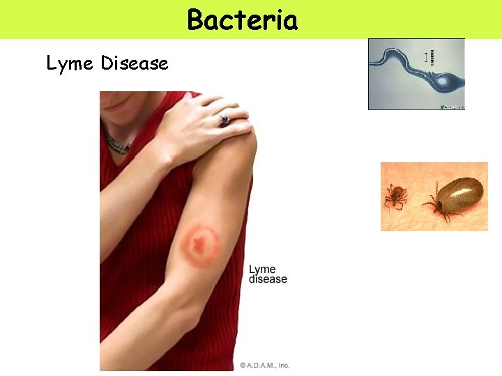 Bacteria Lyme Disease 