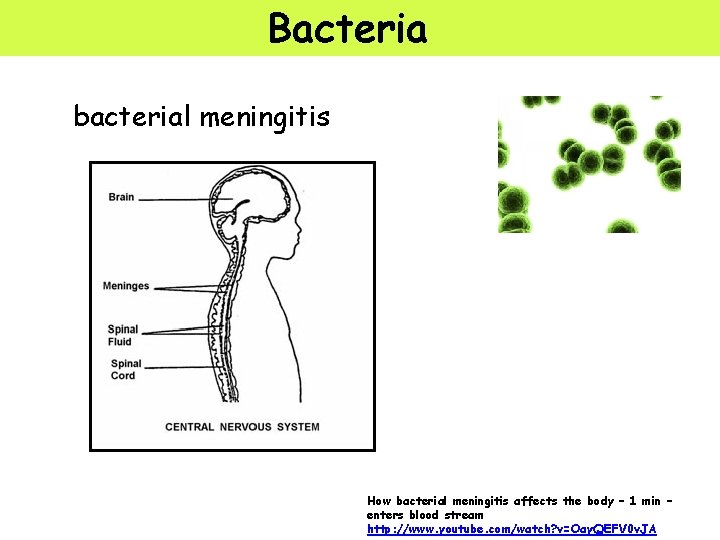 Bacteria bacterial meningitis How bacterial meningitis affects the body – 1 min – enters