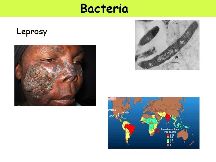 Bacteria Leprosy 