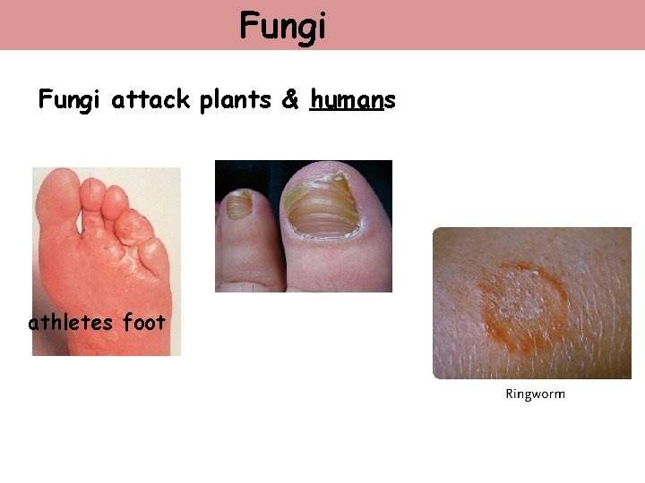 Fungi attack plants & humans athletes foot 