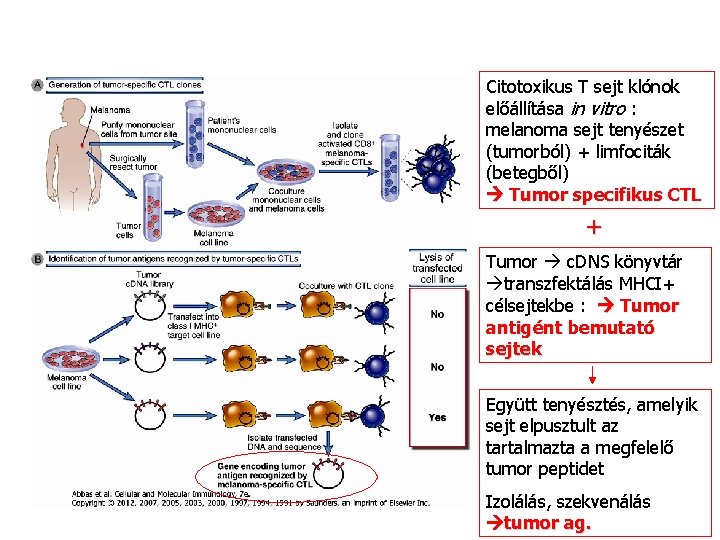 Citotoxikus T sejt klónok előállítása in vitro : melanoma sejt tenyészet (tumorból) + limfociták