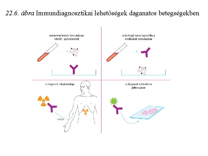 22. 6. ábra Immundiagnosztikai lehetőségek daganatos betegségekben 22. 6. ábra Immundiagnosztikai lehetőségek daganatos betegségekben