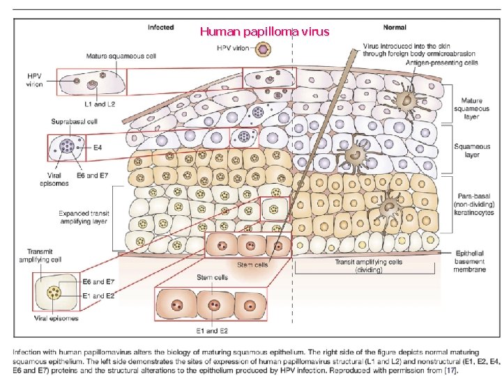 Human papilloma virus 