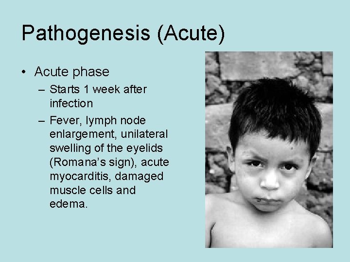 Pathogenesis (Acute) • Acute phase – Starts 1 week after infection – Fever, lymph Pathogenesis (Acute) • Acute phase – Starts 1 week after infection – Fever, lymph