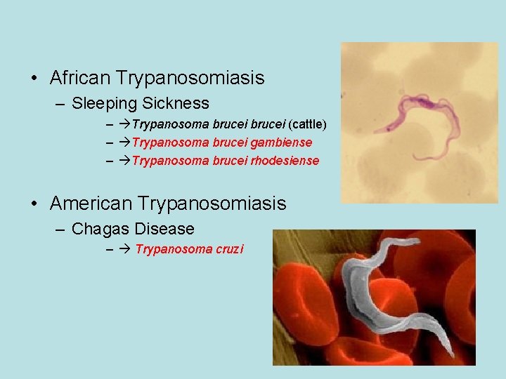 • African Trypanosomiasis – Sleeping Sickness – Trypanosoma brucei (cattle) – Trypanosoma brucei • African Trypanosomiasis – Sleeping Sickness – Trypanosoma brucei (cattle) – Trypanosoma brucei
