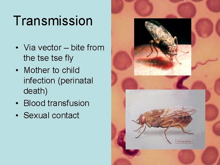 Transmission • Via vector – bite from the tse fly • Mother to child Transmission • Via vector – bite from the tse fly • Mother to child