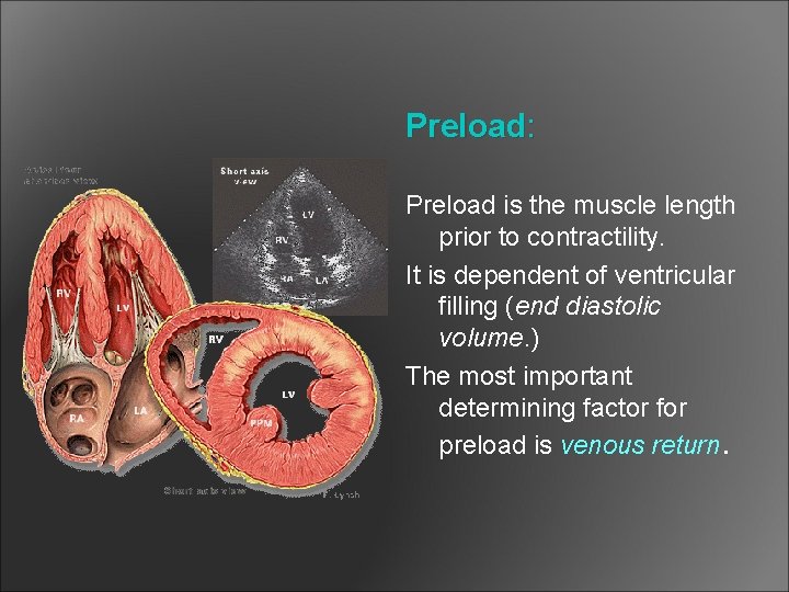 Preload: Preload is the muscle length prior to contractility. It is dependent of ventricular