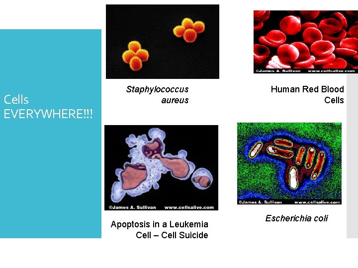 Cells EVERYWHERE!!! Staphylococcus aureus Apoptosis in a Leukemia Cell – Cell Suicide Human Red