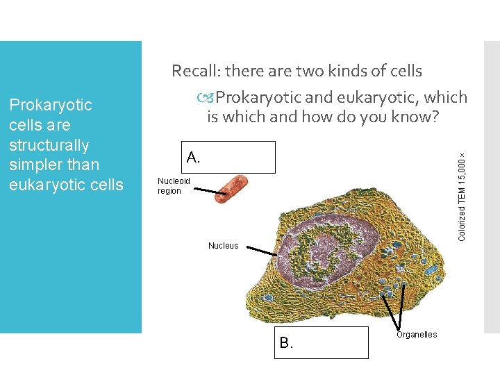 A. Prokaryotic cell Colorized TEM 15, 000 Prokaryotic cells are structurally simpler than eukar