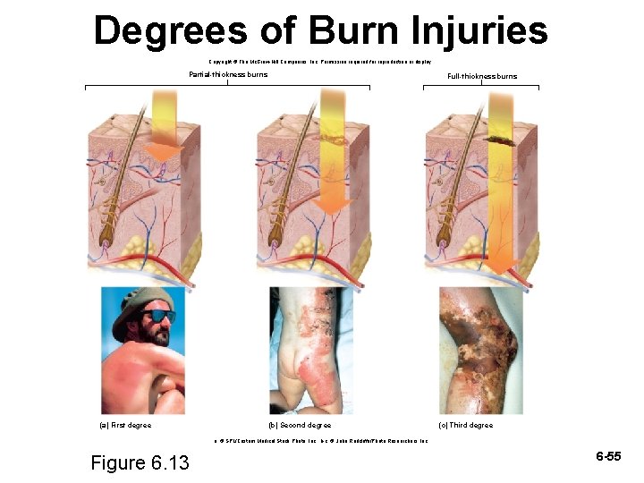 Degrees of Burn Injuries Copyright © The Mc. Graw-Hill Companies, Inc. Permission required for