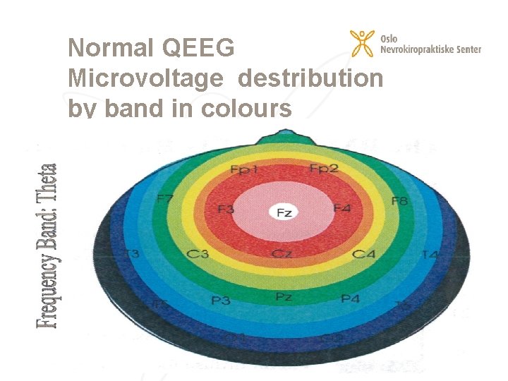 Normal QEEG Microvoltage destribution by band in colours 23. 02. 2021 10 
