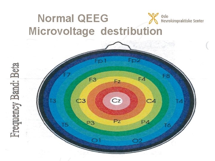 Normal QEEG Microvoltage destribution by band in colours 23. 02. 2021 12 