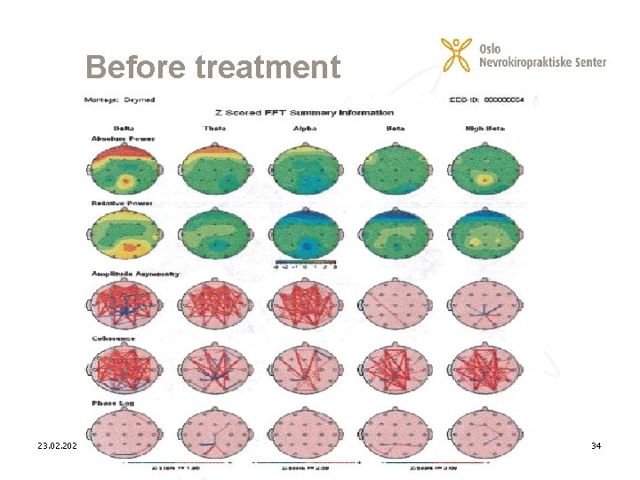 Before treatment 23. 02. 2021 34 