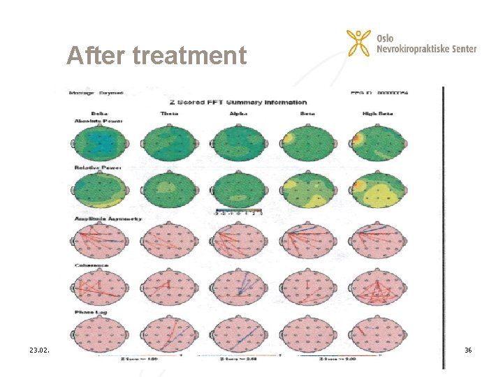 After treatment 23. 02. 2021 36 