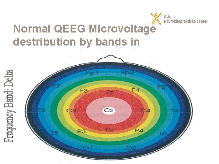 Normal QEEG Microvoltage destribution by bands in colours 23. 02. 2021 9 