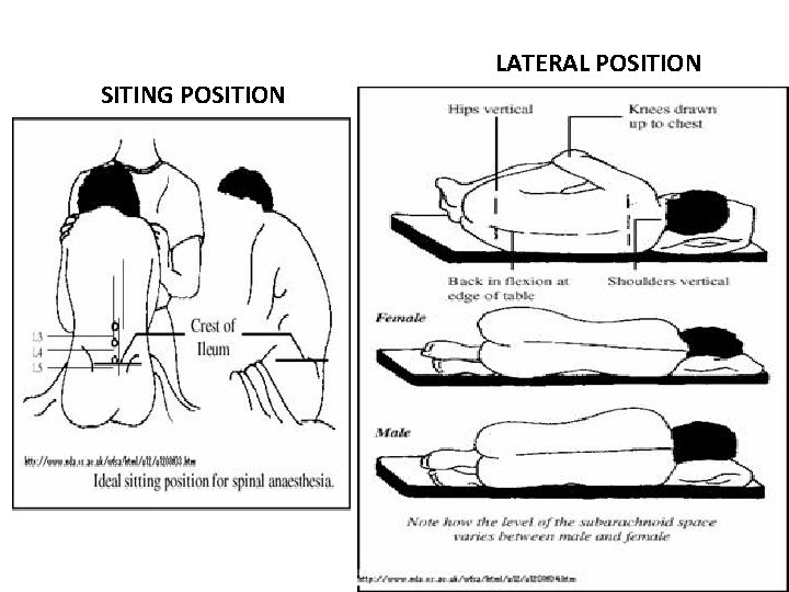 SITING POSITION LATERAL POSITION 