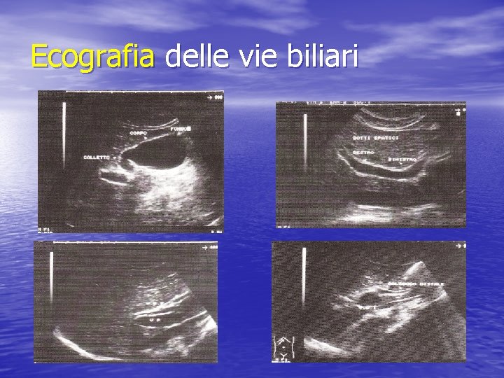 Ecografia delle vie biliari 