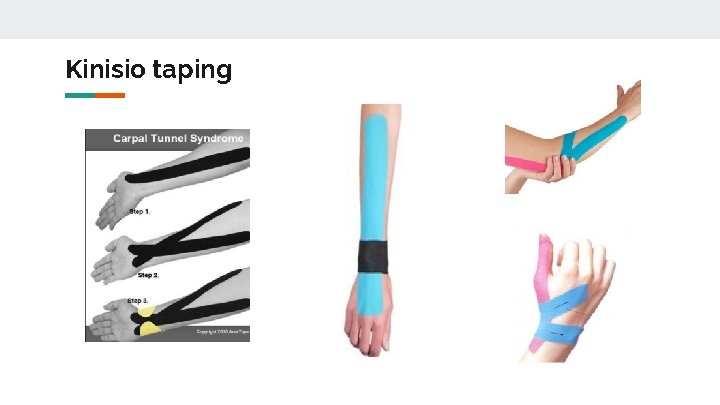 Kinisio taping 