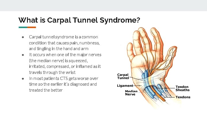 What is Carpal Tunnel Syndrome? ● ● ● Carpal tunnel syndrome is a common