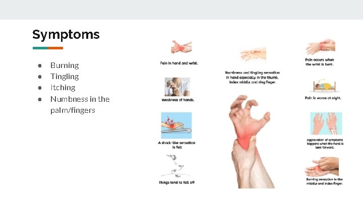 Symptoms ● ● Burning Tingling Itching Numbness in the palm/fingers 