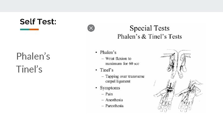 Self Test: Phalen’s Tinel’s 