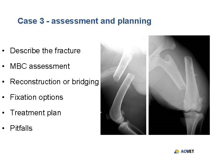 Case 3 - assessment and planning • Describe the fracture • MBC assessment • Case 3 - assessment and planning • Describe the fracture • MBC assessment •