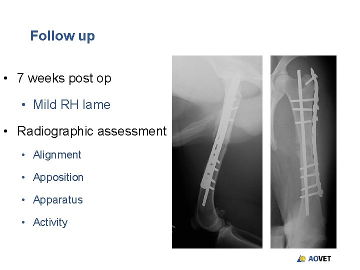 Follow up • 7 weeks post op • Mild RH lame • Radiographic assessment Follow up • 7 weeks post op • Mild RH lame • Radiographic assessment