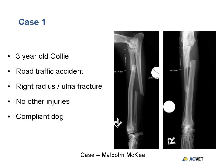 Case 1 • 3 year old Collie • Road traffic accident • Right radius Case 1 • 3 year old Collie • Road traffic accident • Right radius