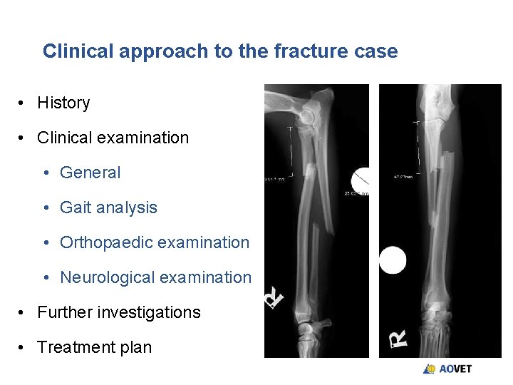Clinical approach to the fracture case • History • Clinical examination • General • Clinical approach to the fracture case • History • Clinical examination • General •